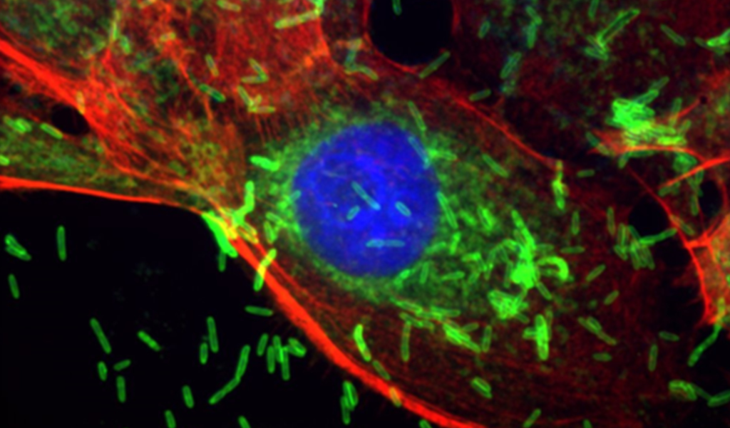 Oral Bacterium May Promote Breast Cancer Development and Spread