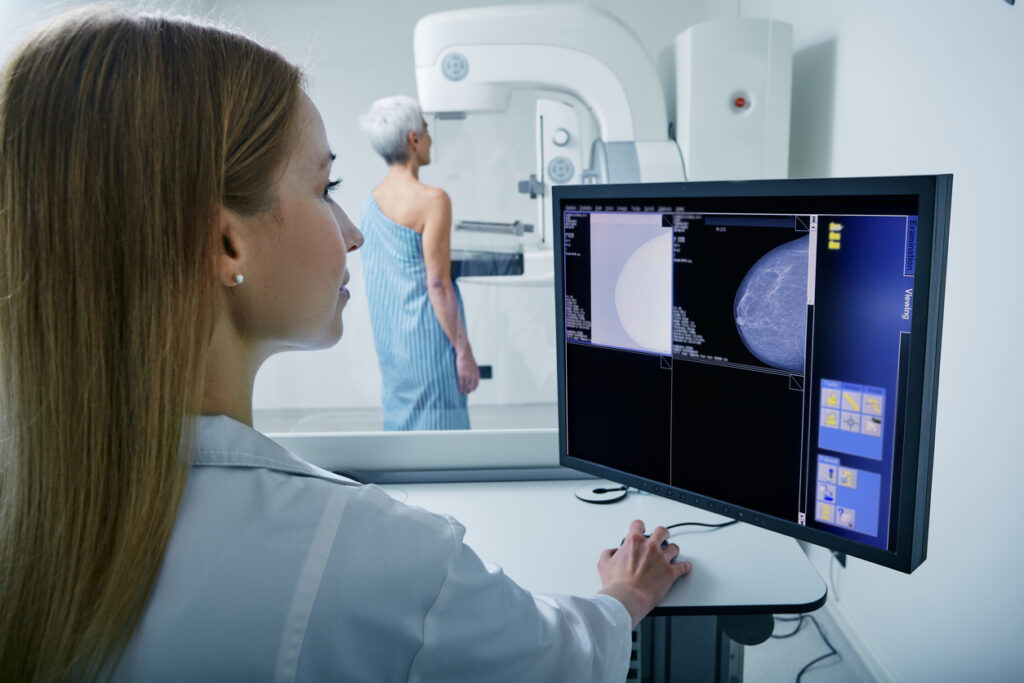 AI and Mammograms